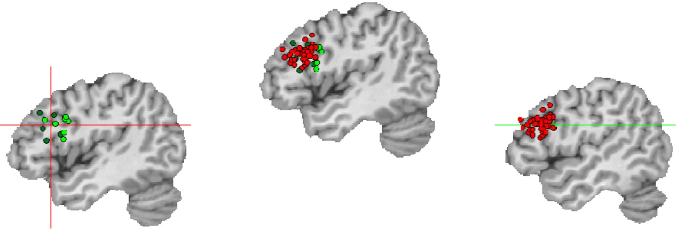 Figure 17. Les clusters F3opd impliqués dans le traitement sémantique et de la phrase