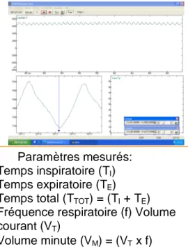 Figure 6. Pléthysmographe et dispositif de mesure 