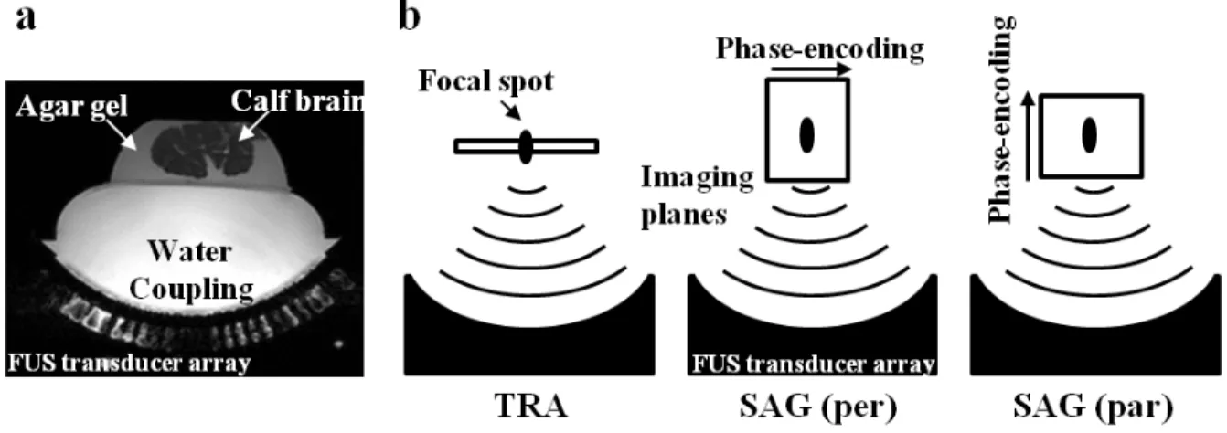 Figure 1.13(a, b): a- Sagittal view of the MRgFUS experimental setup. b- Imaging  configurations tested in this work for MR ARFI keyhole acquisitions
