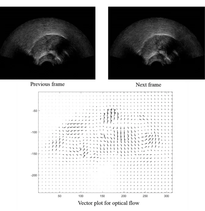 Figure 3-3 Application of optical-flow in ultrasound tongue images. 