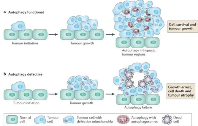 Fig.  11  Rôle  pro-angiogénique  de  l’autophagie.   a)  L’autophagie est  surexprimée  dans  certains  cancers,  induisant  la  formation  de  régions  tumorales  en  hypoxie,  permettant  ainsi  la  survie  des  cellules  tumorales