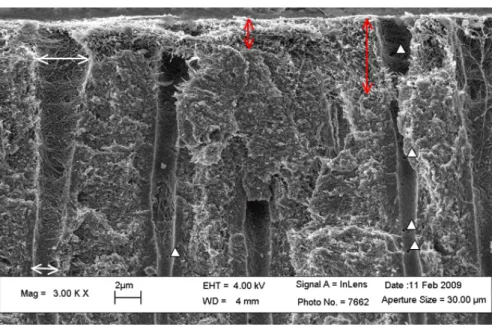 Figure 1.26 – Image électronique de dentine déminéralisée en surface à l’acide phosphorique H 3 PO 4 (à 37 %)