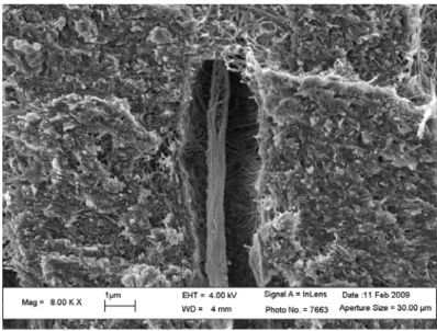 Figure 1.28 – Image électronique de dentine déminéralisée en surface à l’acide phosphorique H 3 PO 4 (à 37 %)