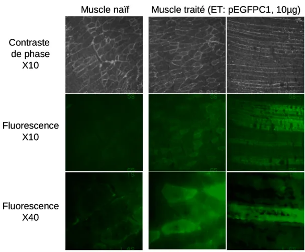 Fig. 9 – Visualisation des fibres musculaires fluorescentes. Les muscles sont injectés et élec-
