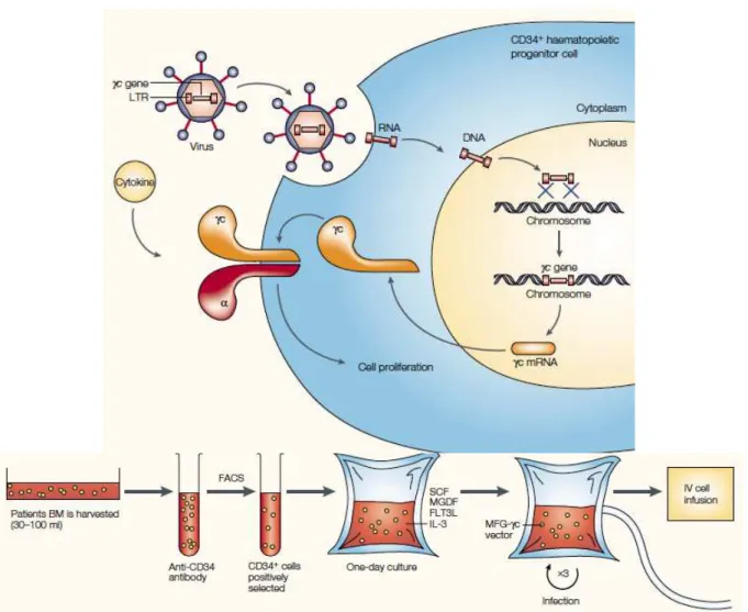 Figure 4 : Principe et protocole de la thérapie génique des enfants atteints de SCID-X  (D’après Fischer et al., 2002) 