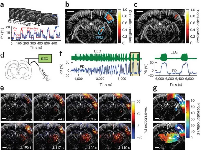Figure I-6 : Première preuve de concept de l’imagerie fonctionnelle cérébrale par ultrasons (fUS) chez 