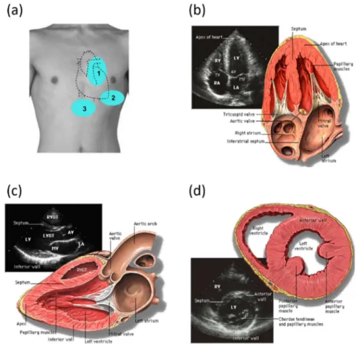 Figure 1.7 Transthoracic echocardiography. (a) Three of the acoustic windows used to image the  heart
