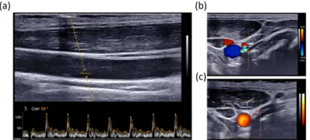 Figure 1.10 Visualisation of Doppler information of the carotid artery. (a) Spectrogram of the carotid  blood flow through a small ROI