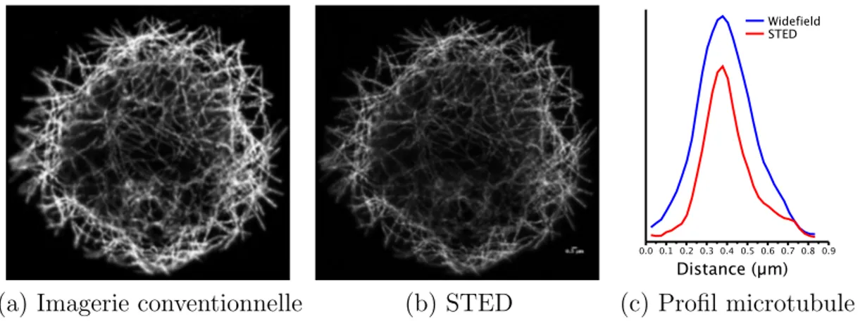 Figure 1.7: Exemple de super-r´esolution par m´ethode STED : (a) image obtenue par un microscope widefield (et donc limit´e par la formule de Abbe), (b) image obtenue par un microscope Leica avec technologie STED (taille du pixel ∼25 nm)