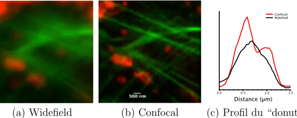 Figure 1.11: Comparaison entre widefield et confocal : (a) image obtenue par un microscope optique widefield en plein champ, dont la r´esolution est d´efinie par la limite de Abbe ( 1.1 ), (b) mˆeme image obtenue grˆ ace ` a un syst`eme confocal