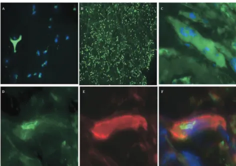 Fig 2. Detection of human cells in myoblast- myoblast-seeded collagen sponge (Gelfoam; Pharmacia &amp; Upjohn, Kalamazoo, MI) before (A) and after (B–F) implantation in infarcted  myocar-dium