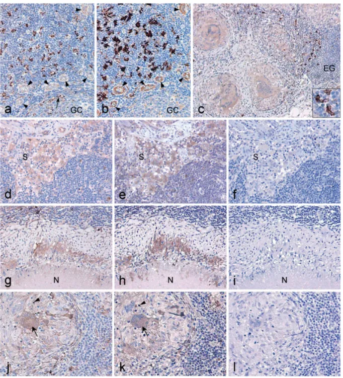 Figure 1. Immunohistochemical analysis of EBI3 and p28 expression in tuberculous, sarcoid, and control lymph nodes