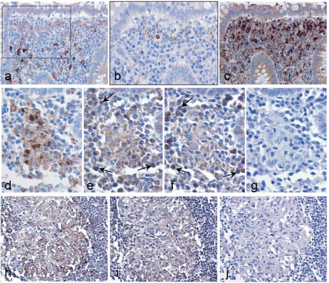 Figure 2. Immunohistochemical analysis of EBI3 and p28 expression in intestinal tissues from control (a – c) and CD patients