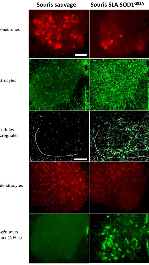 Figure 8 : Modifications des populations cellulaires de la moelle épinière mises en évidence chez les souris SLA SOD1 G93A à P115.
