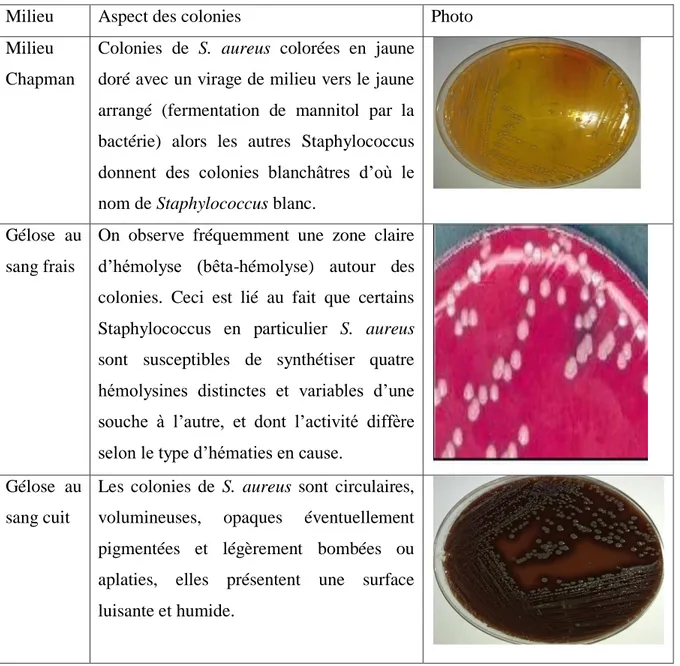 Tableau N°III : Aspect des colonies de S. aureus sur différents milieux. 