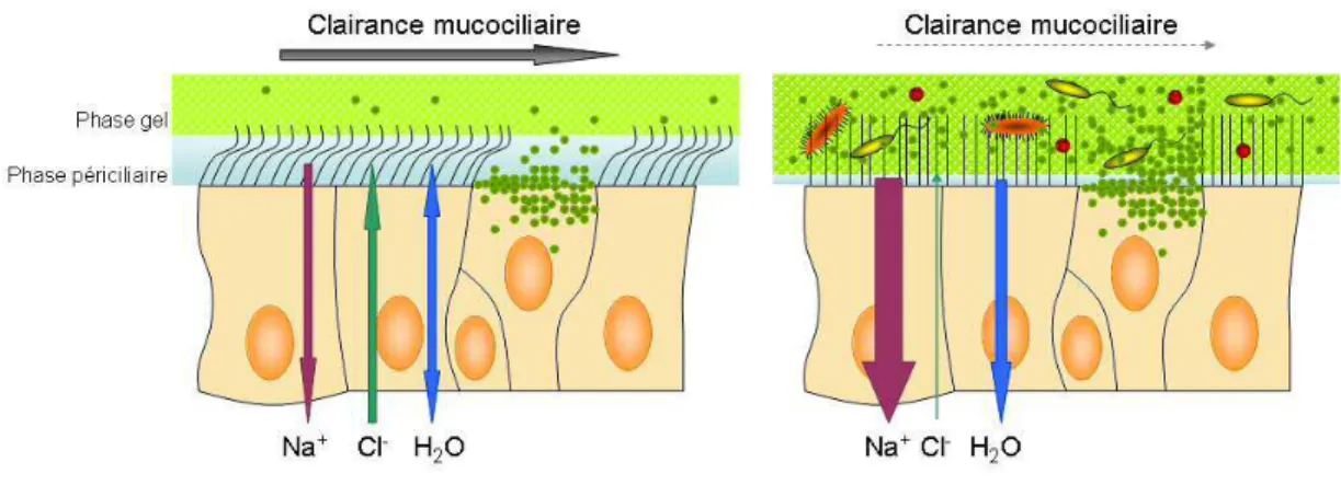 Figure 7 : Conséquence du dysfonctionnement de transport ionique sur la clairance  mucociliaire dans la mucoviscidose 