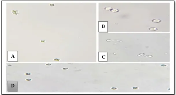 Figure 6: Aspect microscopique de quelques éléments retrouvés dans les urines. 