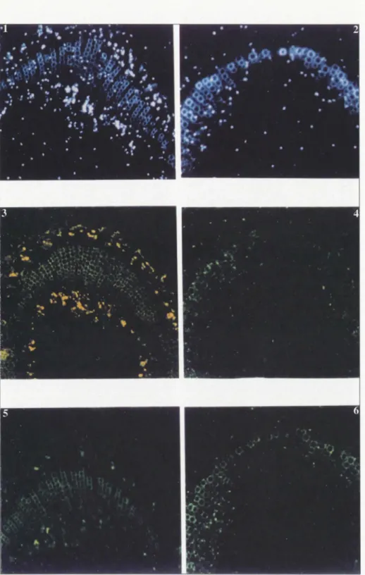Figure  5.  Méthodes  histologiques  de  diagnostic  des  phytoplasmes:  fluorescence  de  l 'ADN, 