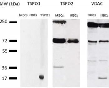 Figure 1.9 . Immunoblot showing expression of TSPO1, TSPO2 and VDAC in healthy and  P