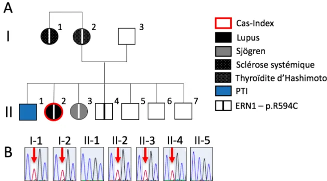 Figure	6	:	Arbre	généalogique	et	séquençage	d’ERN1	dans	la	famille	A.	(A)	Arbre	généalogique	de	la	famille	A.	(B)	 Séquençage	de	Sanger	du	gène	ERN1	montrant	le	variant	observé	chez	les	divers	membres	de	la	famille	séquencés.	La	 flèche	rouge	vise	le	nucléotide	muté.	