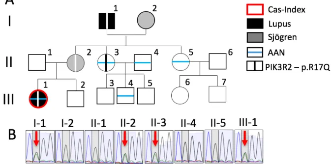 Figure	7 	:	 Arbre	généalogique	et	séquençage	de	PIK3R2	dans	la	famille	B.	(A)	Arbre	généalogique	de	la	famille	B.	AAN	:	 Anticorps	anti-nucléaires.	(B)	Séquençage	de	Sanger	du	gène	PIK3R2	montrant	le	variant	observé	chez	les	divers	membres	de	 la	famille	séquencés.	La	flèche	rouge	vise	le	nucléotide	muté.
