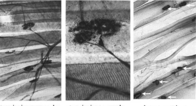 Figure  3  :  photographies  représentatives  des  terminaison  axonales  et  de  leur  plaque  motrice   (http://histoblog.viabloga.com/texts/le-tissu-musculaire-strie)