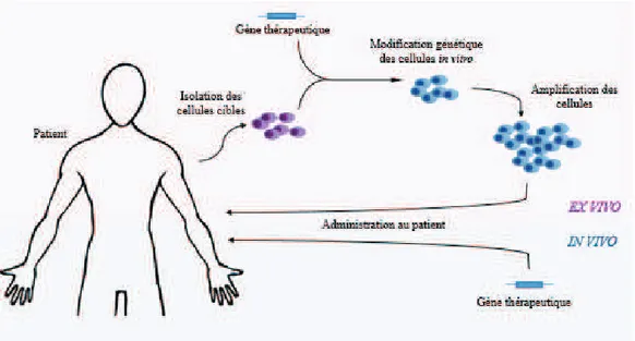 Figure 3: Stratégies de thérapie génique ex vivo et in vivo. 