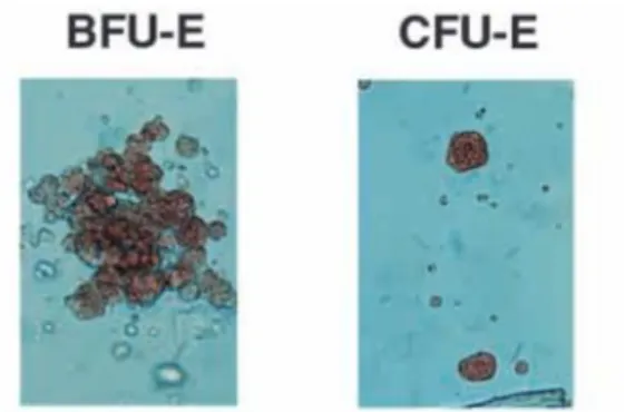 Figure 9: Photo macroscopique d’une BFU-E et d’une CFU-E observée en milieu 