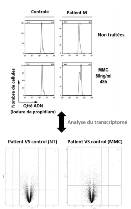 Figure 5 : Analyse du transcriptome au sein des fibroblastes du patient M. 