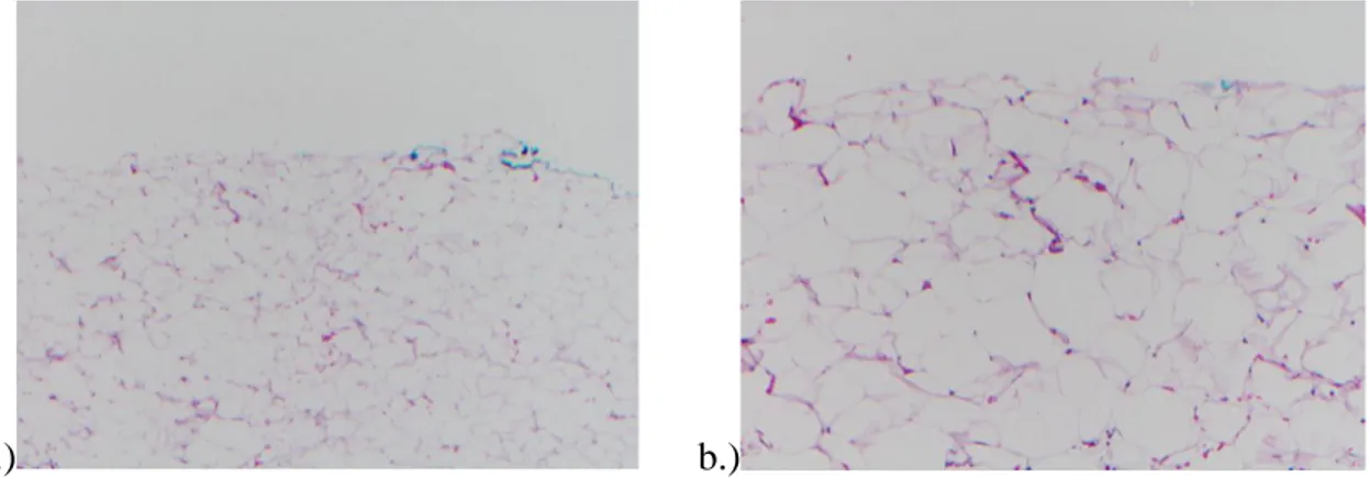 Figure I.2.2. Normal fatty tissue with large fat cells. Histology (H&amp;E – Hematoxylin &amp; Eosin 