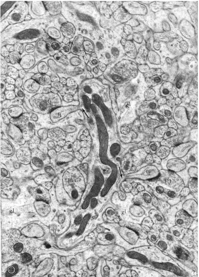 Fig 6: Electron micrograph of Purkinje cell dendrites and synapses. 