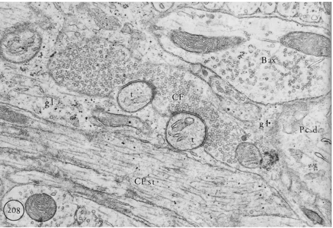 Fig 7: Electron micrograph showing climbing fiber synapses on Purkinje cell thorns. 