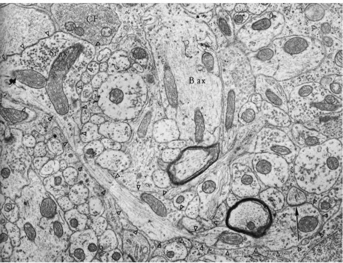 Fig 11: Micrograph representing stellate cell and basket cell axons in molecular layer