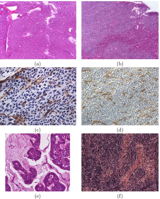 Figure 2.2 – Exemples d’images de tissus diﬀérents avec des marqueurs diﬀérents. (a) et (b) sont des images de foies de souris métastasés avec un marquage d’hématoxyline et d’éosine