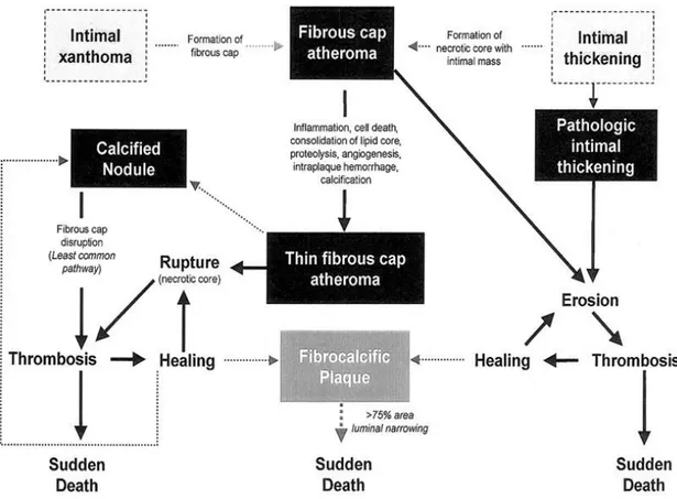 Figure  2:  Simplified  scheme  of  the  classification  of  lesions  modified  by  Virmani  after  AHA  recommendation,  The  boxed  areas  represent  the  seven  types  of  lesions