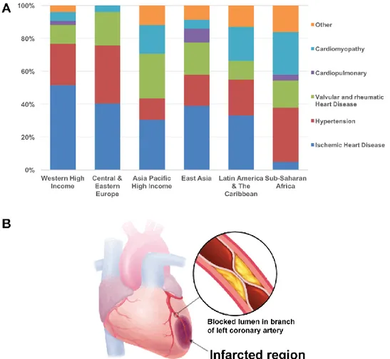 Figure 1.1 Ischemic heart disease is the major risk factor of heart failure in high income countries worldwide