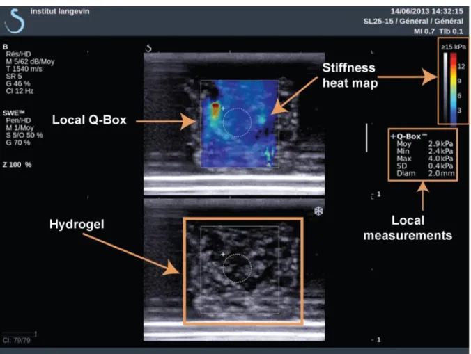 Figure 4.4 Elasticity measurement with Shear Wave Elasticity on Aixplorer ®  Ultrasound System 