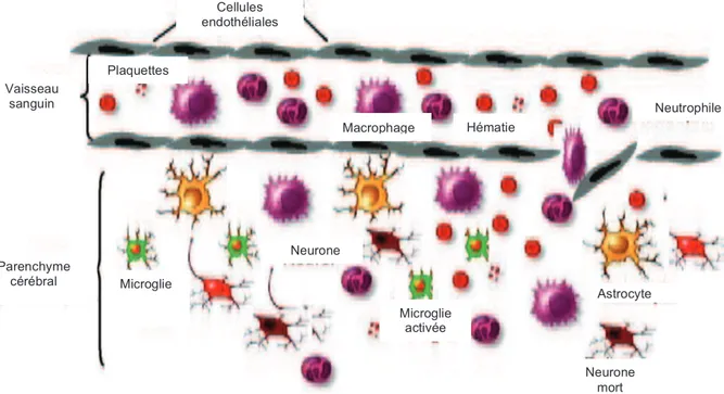 Figure 5 : La BHE endommage et les diffrentes sources cellulaires de la neuro-inflammation   la suite dÕun TC (DÕaprs Ziebell &amp; Morganti-Kossmann, 2010)