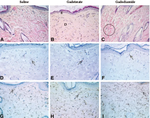 FIGURE 5. Histologic skin lesions in treated, renally impaired rats: long-term study (320 magnification)