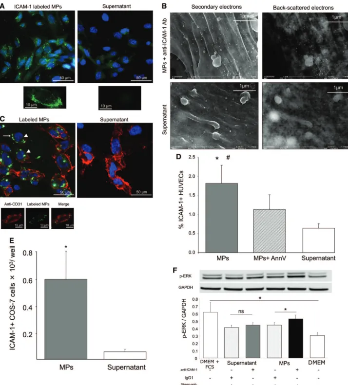 Figure 3. ICAM-1 transfer to target cells. A, Plaque MPs were labeled with an anti–ICAM-1 antibody, washed to remove unbound