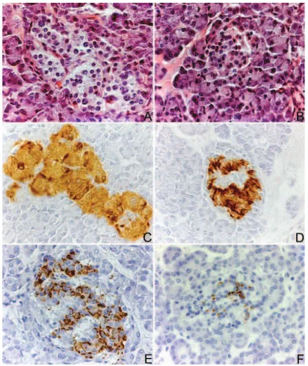 FIG. 1. Islet mosaicism. A and B, On H&amp;E-stained sections, the typical feature of this new