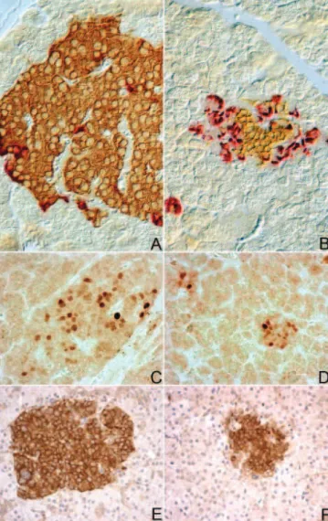 FIG. 4. Insulin mRNA and somatostatin cells, p57, and SUR1. A and B,