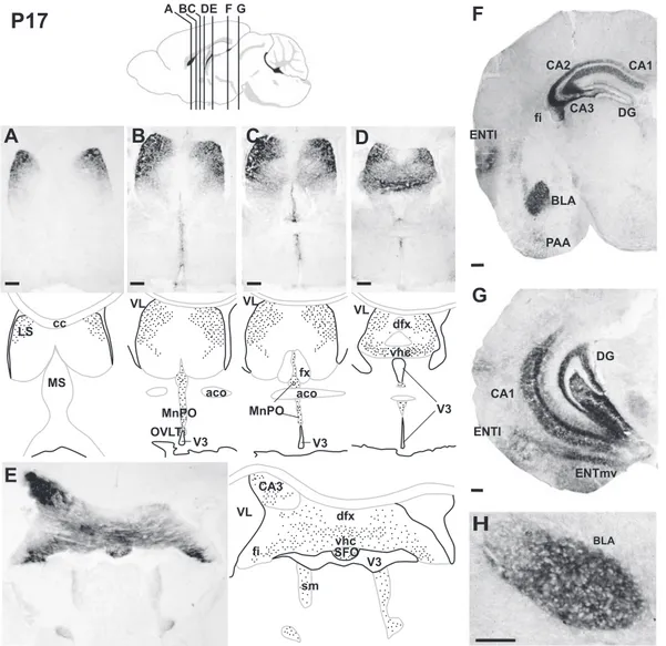 FIG. 2. Spatial distribution of transgene expression in the forebrain at P17. Coronal sections from dissected brains of P17 transgenic male mice