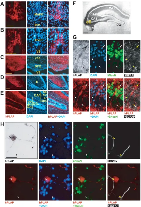 FIG. 3. High magnification of transgene expression in the forebrain (A–E) and colocalization with