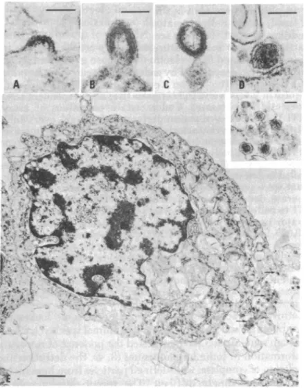 Figure 1 : Premières observations du bourgeonnement du virus HTLV-1 dans des cellules HUT-102  par  l’équipe du Dr Robert Gallo