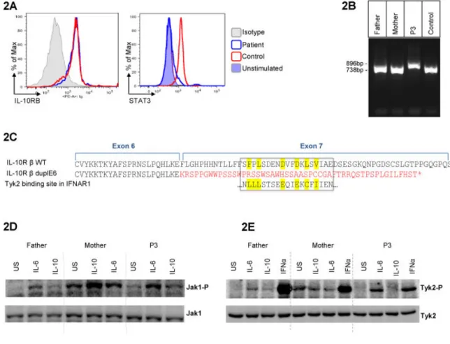 Figure 2: Duplication of IL-10R2 exon 6 results in loss of exon 7 encoded intracellular  domain and prevents Tyk2 activation 