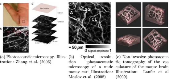 Figure 1.10: Examples of photoacoustic microscopy &amp; photoacoustic tomogra- tomogra-phy