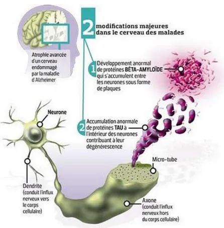 Figure 1 : Mécanismes physiopathologiques de la maladie d’Alzheimer  
