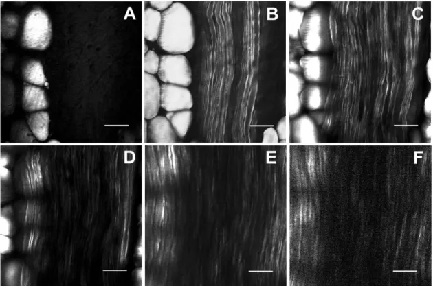 Figure 3-1. Sciatic nerve imaged using E-CARS (A) 0 μm, (B) 10 μm, (C) 20 μm, (D) 30 μm,  (E)  40  μm  and  (F)  50  μm  below  the  surface