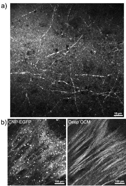 Figure  3-2.  Deep-OCM  myelin  imaging.    (a)  Maximum  projection  of  a  40×  deep-red  deep- deep-OCM  image  stack  in  a  cortex  slice  (80  images  taken  in  0.4µm  z  steps,  z=250µm  below  the  brain  surface,  total  exposure  time  84  secon